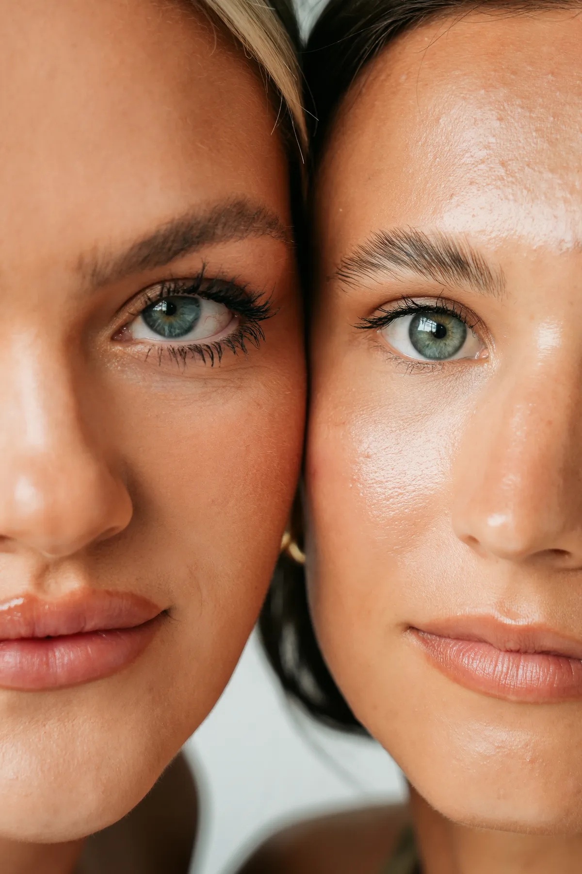 Dermal filler injection treatment in Edina Minneapolis clinic