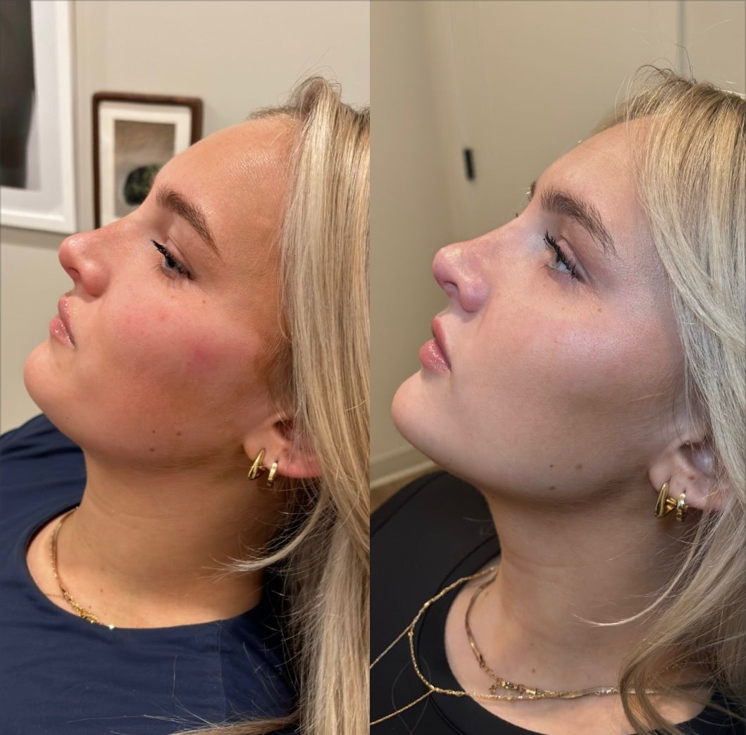 ff-7 . face , neck
