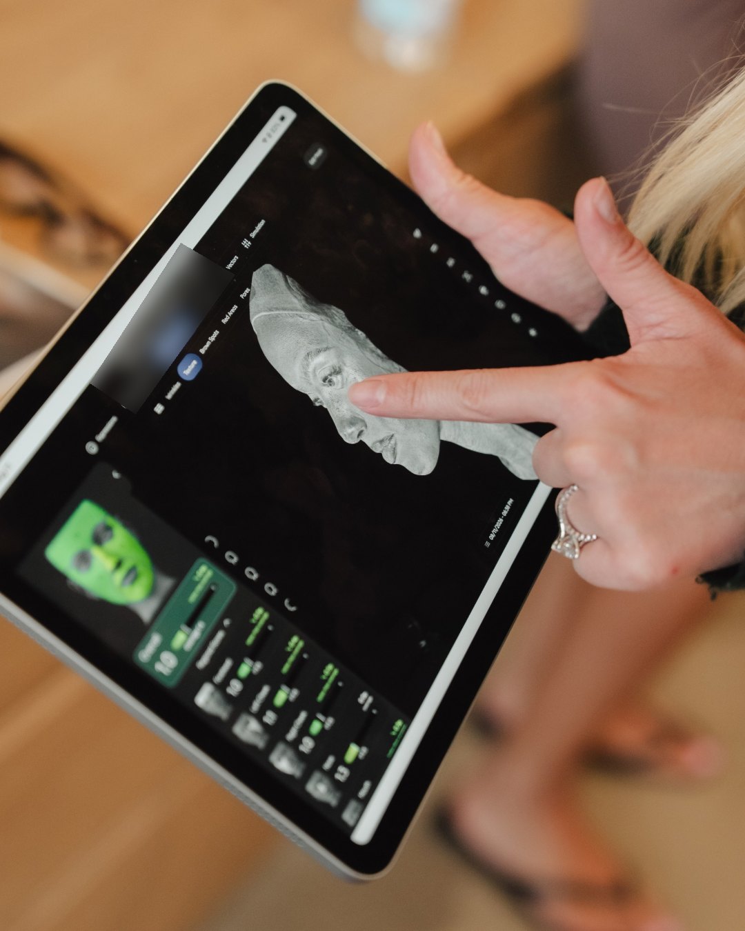 A provider reviewing a 3D skin model on a tablet